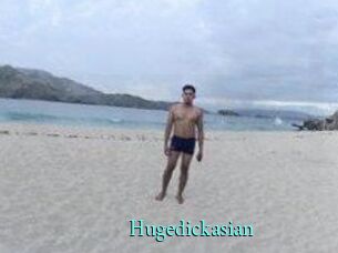 Hugedickasian