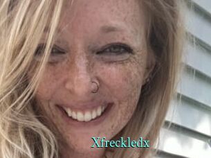 Xfreckledx